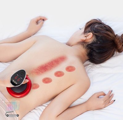 Вакуумний інфрачервоний масажер Red Scraping з підігрівом для антицелюлітного, баночного та Гуаша масажу