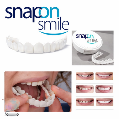 Знімні вініри для зубів Snap On Smile на 2 щелепи &bull; Накладні вініри на верхні та нижні зуби для естетичної білосніжної усмішки